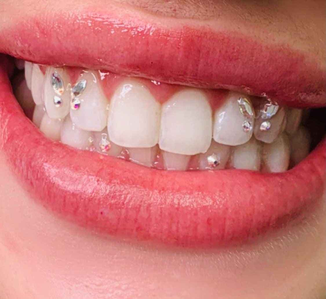 Teeth Jewels